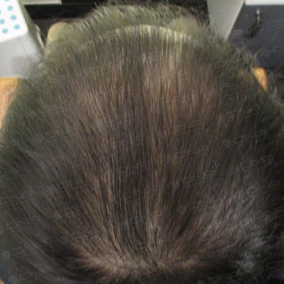 case3_1a